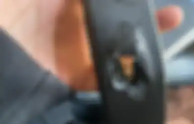 Ajaib, Remaja Ini Berhasil Selamat dari Peluru Nyasar Berkat Headset Razer di Kepala