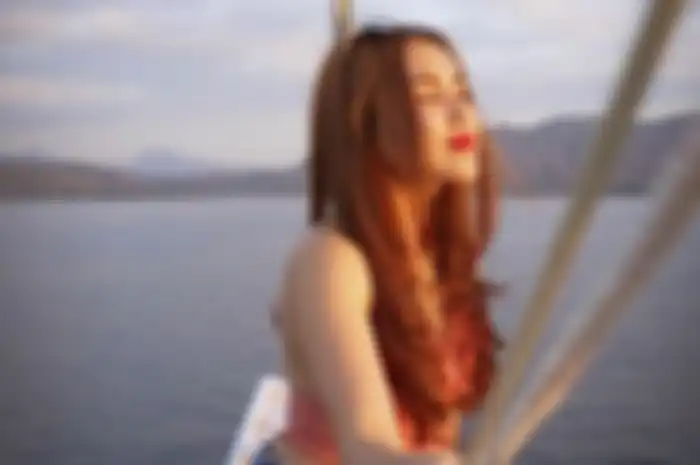 Kondisi lutut Ayu Ting Ting bermasalah