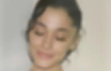 Usianya Kepala 3, Penyanyi Ini Menyesal Jalani Filler Bibir di Umur 20-an, Begini Penampilannya Kini!