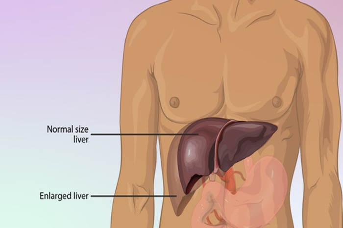 (ilustrasi) Organ hati berfungsi untuk mengambil sari-sari makanan di dalam darah dan menghasilkan empedu.