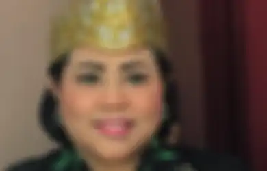 Nunung Srimulat Kanker Payudara: Aku Terima Semua Ujian dari-Mu!