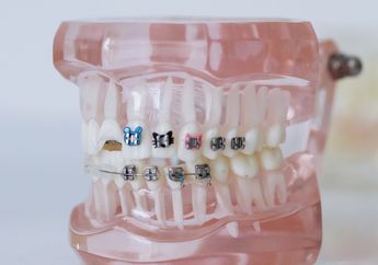 Bibirnya Seketika Jontor dan Bernanah Usai Pasang Behel, Ternyata Wanita Muda Ini Nekat Pakai Kawat Gigi Murah Hanya Demi Bergaya