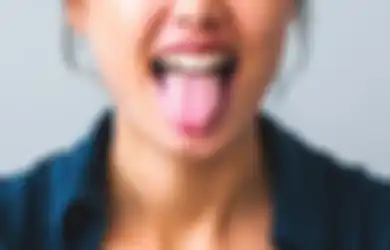 Ketahui Penyebab Lidah Putih. Berhubungan dengan Asam Lambung?