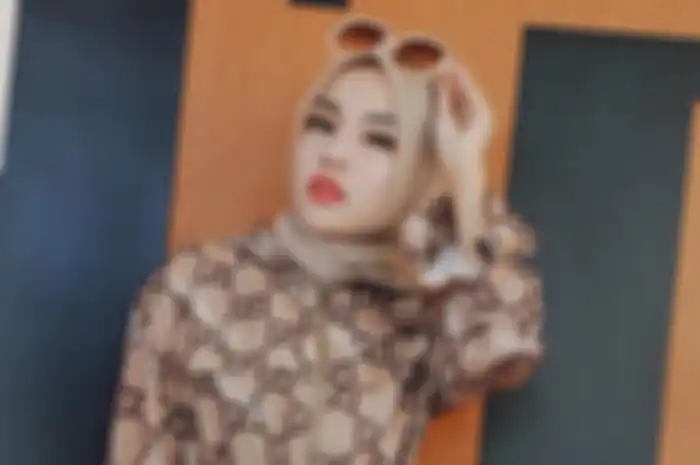 Medina Zein mengalami bipolar