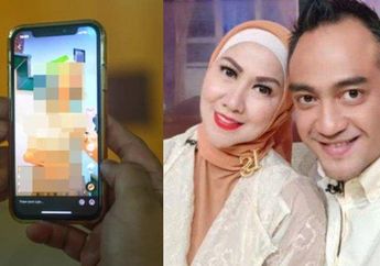 Venna Melinda Susah Payah Kabur Diserang Ferry Irawan, Berteriak Minta Tolong di Koridor Hotel Sambil Berdarah-darah