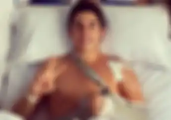 Video Marc Marquez Tunjukin Bekas Jahitan, Duh Bikin Ngilu!