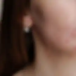 Gampang, Begini 5 Cara Hilangkan Jerawat Mendem Diwajah, Simak