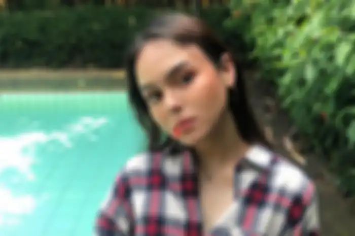 Selebgram Laura Anna meninggal dunia