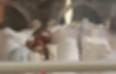 Tangannya saat Dipasangi Cincin Kejutkan Banyak Orang, Bayi Prematur Ini Benar-benar Lahir dengan Tubuh Sangat Kecil, Kurang dari Setengah Kilogram