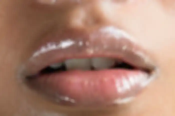 Cara mengatasi bibir hitam