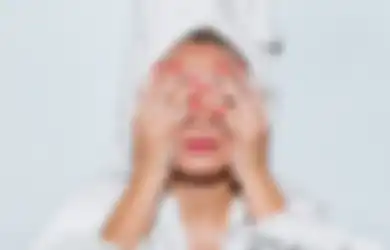 Apa Efek Samping Hydroquinone Meski Bagus untuk Mencerahkan Wajah?