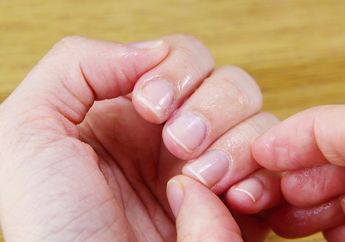 Kuku Menguning Akibat Sering Diwarnai? Bersihkan dengan 4 Cara Alami Ini