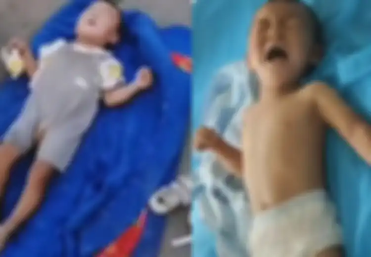 Miris, Bayi yang Derita Cacat Ini Dibuang Orang Tuanya di Pinggir Jalan Hanya dengan Selimut dan Botol Susu