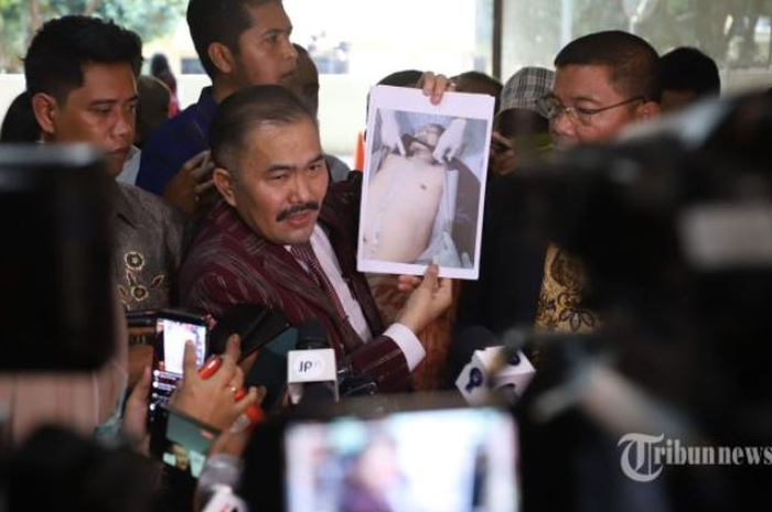 Pengacara keluarga ungkap hasil autopsi ulang jenazah Brigadir J yang mengalami beberapa kejanggalan.