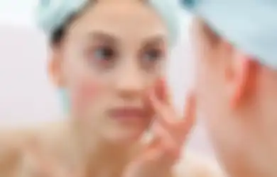 Bisa Hilangkan Jerawat, 3 Kandungan Skincare Ini Malah Bikin Kulit Iritasi