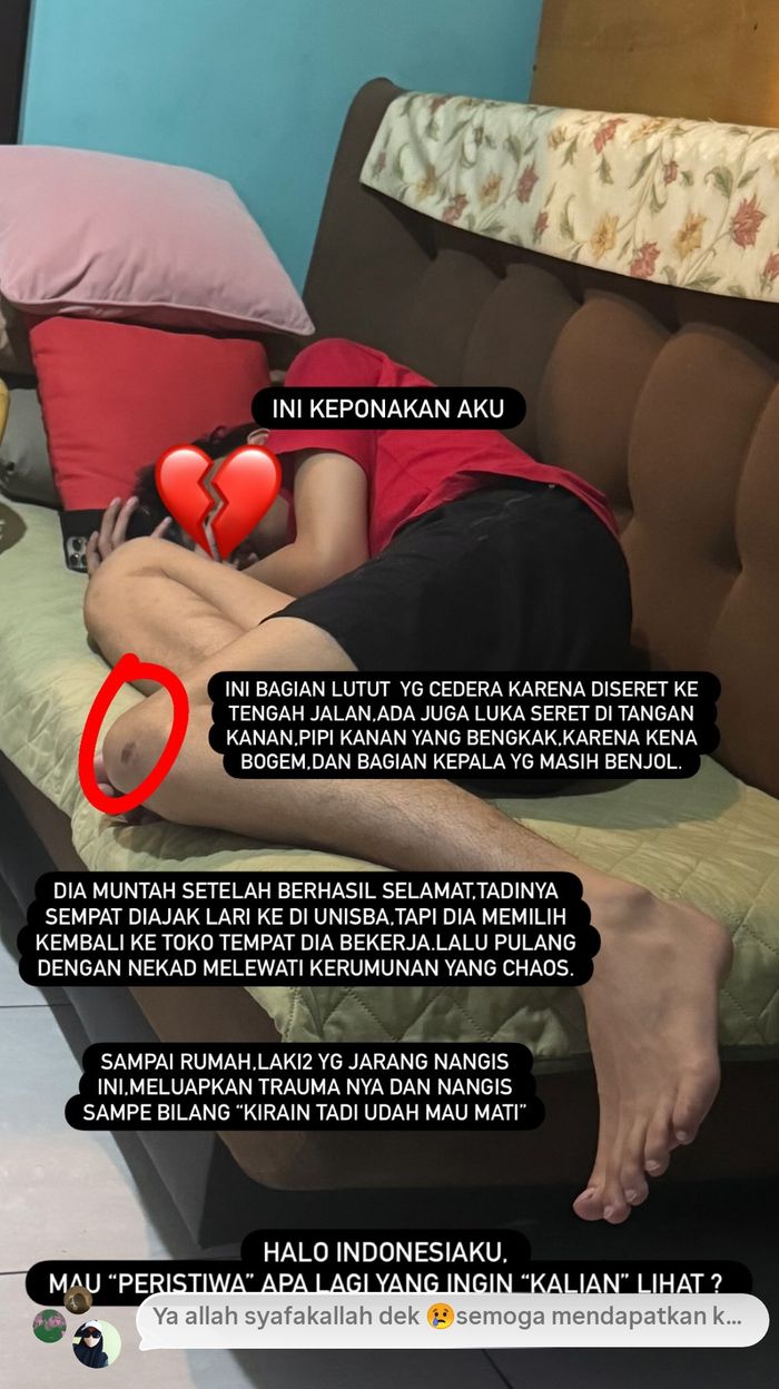 Chika Jessica ungkap kondisi keponakannya yang jadi korban salah pukul saat demo.