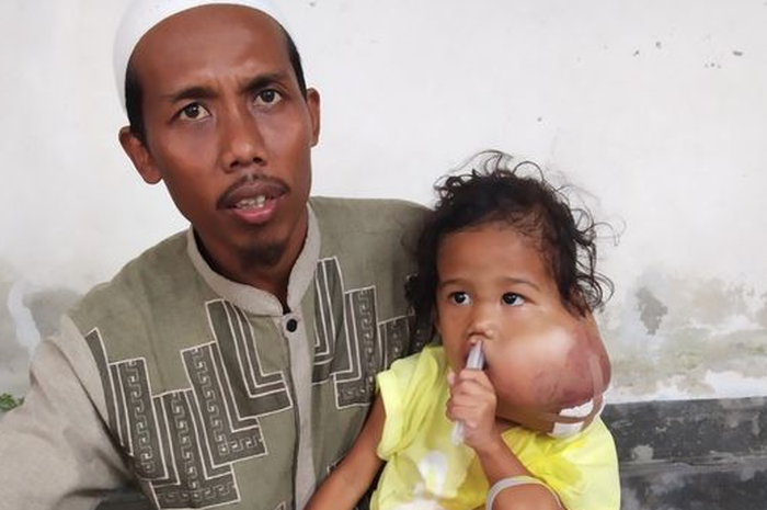 Setiap tumornya kumat atau melakukan aktivitas dengan mulut, Alifa selalu meringis dan merengek kesakitan.