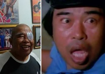 Innalillahi, Dunia Hiburan Kembali Berduka, Sosok Komedian Legendaris Indonesia Eddy Gombloh Meninggal Dunia