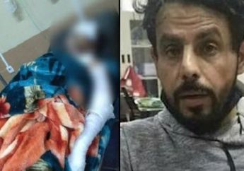 Polisi Duga WNA yang Siram Air Keras Pada Istrinya Seorang Psikopat, Perlakuan Paling Sadis Ini Akhirnya Terkuak Berkat Rekonstruksi Ulang