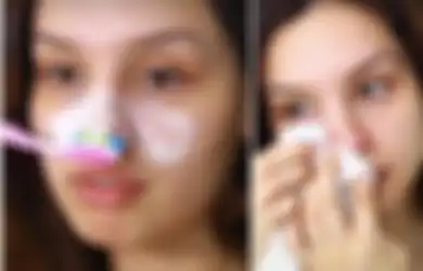 Berbekal Sikat Gigi dan Odol, Begini Cara Hilangkan Komedo pada Hidung dengan Cepat