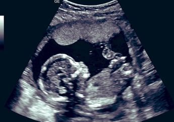 5 Tahun Menikah Dikecam Suami Gegara Dituding Tak Subur, Istri Ini Main Belakang dengan Pebinor dan Langsung Hamil hingga Niat Lakukan Hal Keji Ini