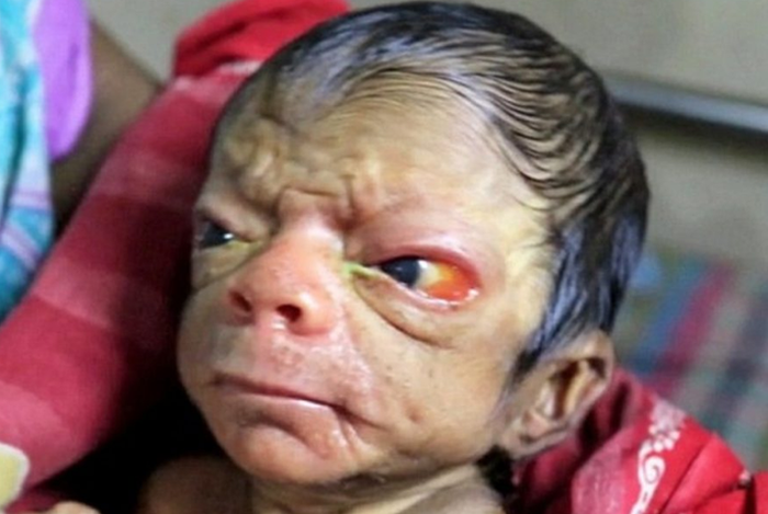 Baru dilahirkan, bayi ini memiliki wajah seperti orang tua.