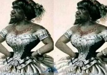 Tragis, Wanita yang Dicap Buruk Rupa Ini Dijadikan Mesin Uang oleh Suaminya, Ketika Meninggal Mayatnya Dipajang sebagai Objek Pameran