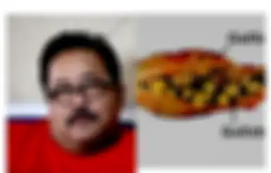Empedunya Diangkat Lantaran Pola Makan Buruk di Masa Lalu, Rano Karno Mewanti-wanti untuk Tak Lakukan Kebiasaan Ini Saat Sarapan