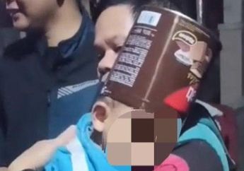 PANIK! Orangtua Balita di Tasik Tak Bisa Lepas Kaleng Biskuit di Kepala Anaknya, Dokter Angkat Tangan Akhirnya Dibawa ke Tempat Ini