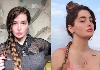 Sakit Hati Diejek Berdada Rata, Gadis ini Nekat Lakukan Operasi Pembesaran Payudara Ekstrem, Begini Akhir Kisah Hidupnya!