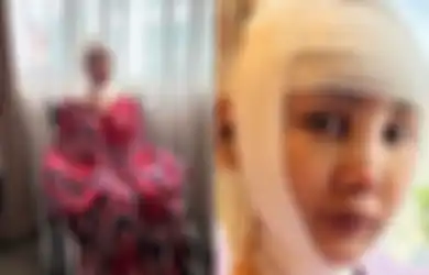 Bodo Amat Meski Wajahnya Dipenuhi Balutan Perban, Lucinta Luna Kepergok Asyik Berdiri dan Berjoget, Cornelia Agatha Sampai Beri Komentar Begini