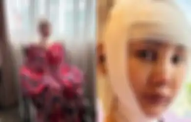 Rela Babak Belur Tak Berbentuk Demi Paras Cantik Sempurna, Lucinta Luna Lagi-lagi Lakukan Ini Usai Operasi Pemotongan Jakun