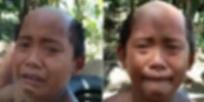Rambut setengah botak