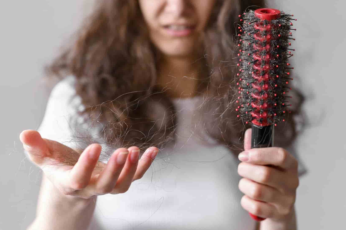Ilustrasi rambut rontok.