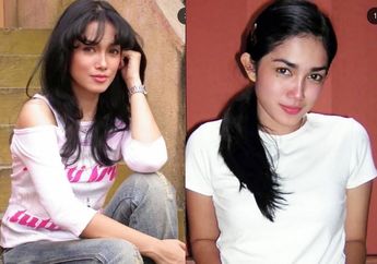 Dulu Sering Nangis, Ussy Sulistiawaty Bongkar Alasan Buang Tahi Lalat Ikonik di Wajah Saat Hamil