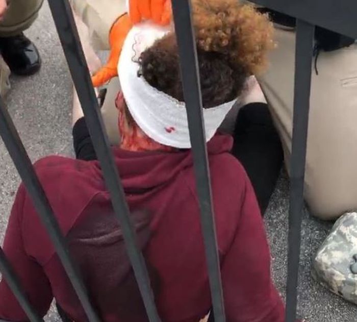 Yasmine terluka parah dalam serangan rasis