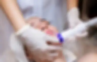 Awas, Jangan Lakukan 5 Hal Ini Setelah Laser Wajah, Perhatikan