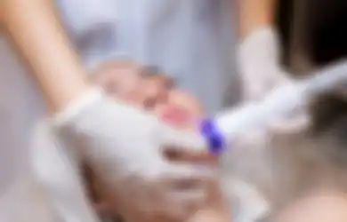 Awas, Jangan Lakukan 5 Hal Ini Setelah Laser Wajah, Perhatikan