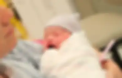 Perhatian Bagi Ibu Hamil, Selain Faktor Keturunan, 4 Kebiasaan ini Bisa Tingkatkan Risiko Anak Terlahir Sumbing