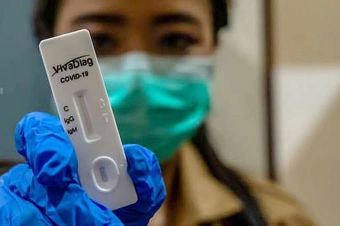 Petugas menunjukkan alat tes cepat (rapid test) COVID-19 saat akan menguji petugas penjaga ruang perawatan di Rumah Isolasi Rumah Dinas Wali Kota Semarang, Jawa Tengah, Senin (30/3/2020)
