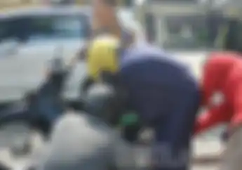 Tragis! Ini yang Harus Dialami Ibu-ibu Akibat Rok yang Dipakai Nyangkut di Gir Motor