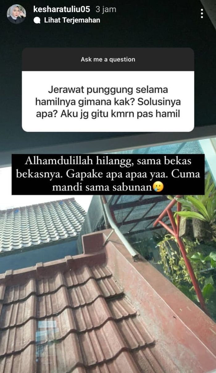 Unggahan Kesha Ratuliu saat mengalami jerawat punggung ketika hamil.