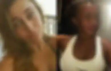 Kecanduan Berjemur Serta Tanning Kulit, Ibu Satu Anak Ini Telan Pil Pahit Derita Penyakit Ini