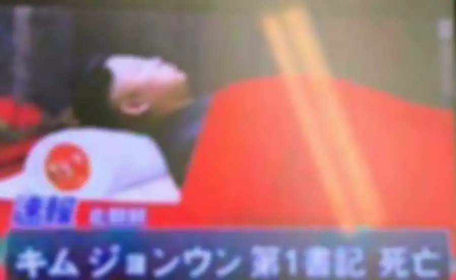 Kim Jong Un dikabarkan alami mati otak