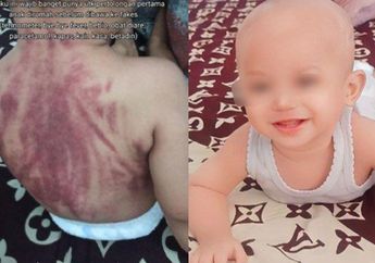 Bayi 15 Bulan Dikerokin Pengasuh Hingga Punggunya Merah Kebiruan, Sang Majikan Malah Maafkan, Ini Alasannya