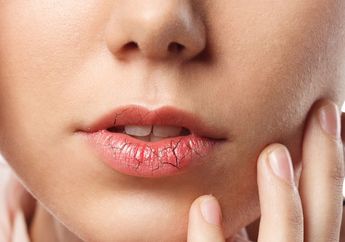 Bibir Pecah-pecah Memasuki Musim Panas Ekstrem? Berikut 8 Cara Mengatasinya