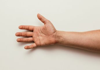 Suka Bikin Minder, Tangan Berkeringat Tak Selalu Jadi Tanda Lemah Jantung, yuk Kenali Alasan di Baliknya!