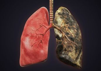 Nyesel Baru Tahu! Ternyata Begini 4 Cara Mudah Membersihkan Paru-paru dari Polusi Udara atau Racun Akibat Asap Rokok!