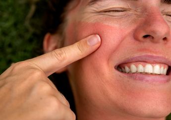 4 Arti Mimpi Wajah Terbakar, Pertanda Rasa Bersalah hingga Citra Diri yang Buruk