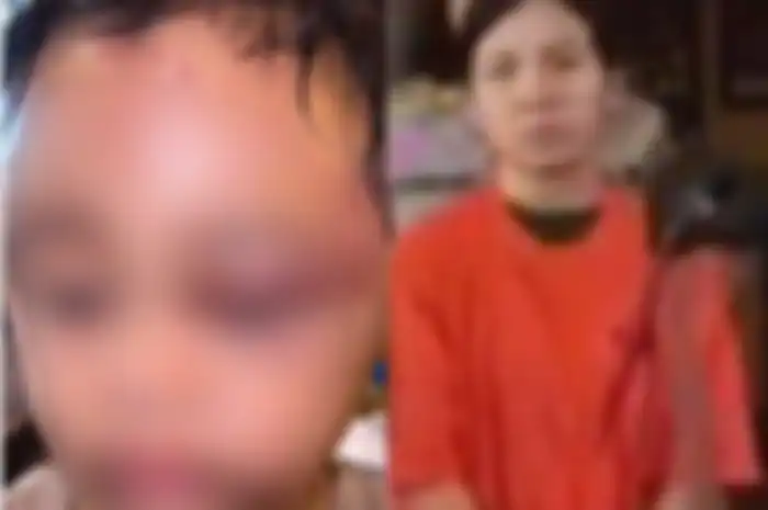 anak Aghnia Punjabi mengalai trauma setelah dianiaya pengasuhnya